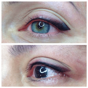 Eye Skin Therapy - Nova Derm Institute