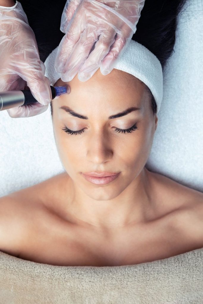 Microneedling Leesburg Virginia