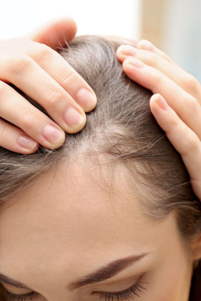 Hair Exosome Treatment Leesburg VA