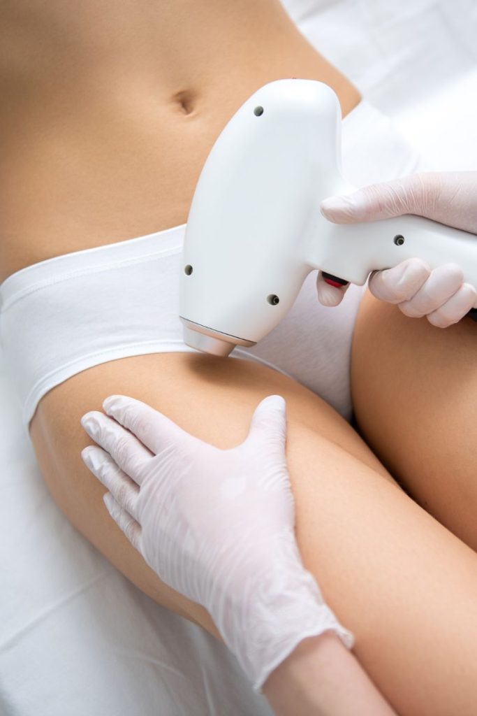 laser hair removal full bikini