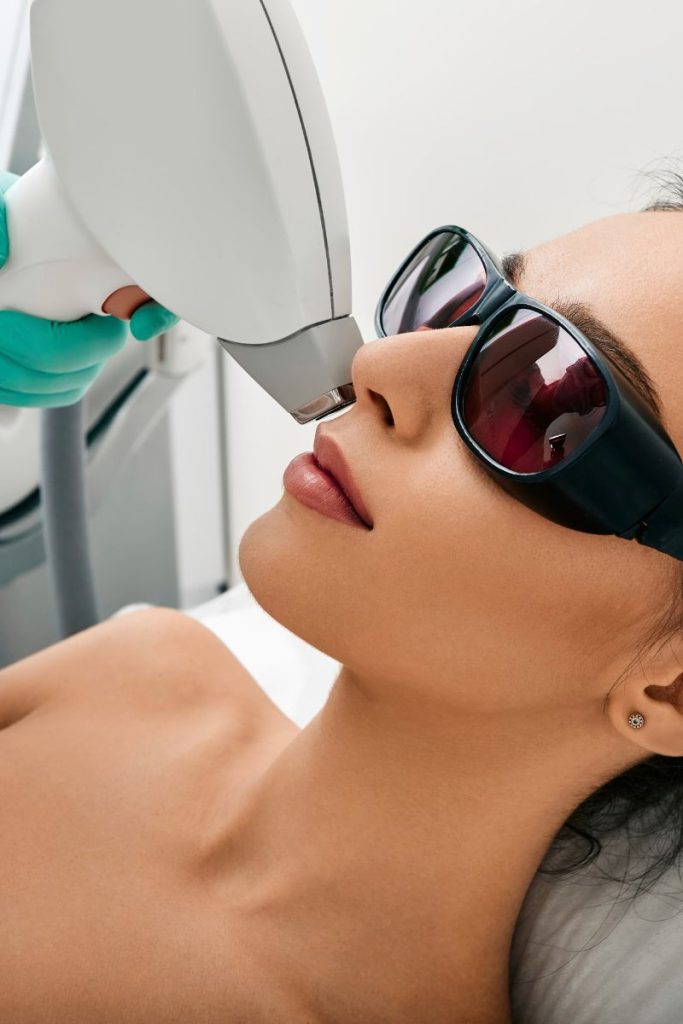 full face hair removal laser_ Leesburg Virginia