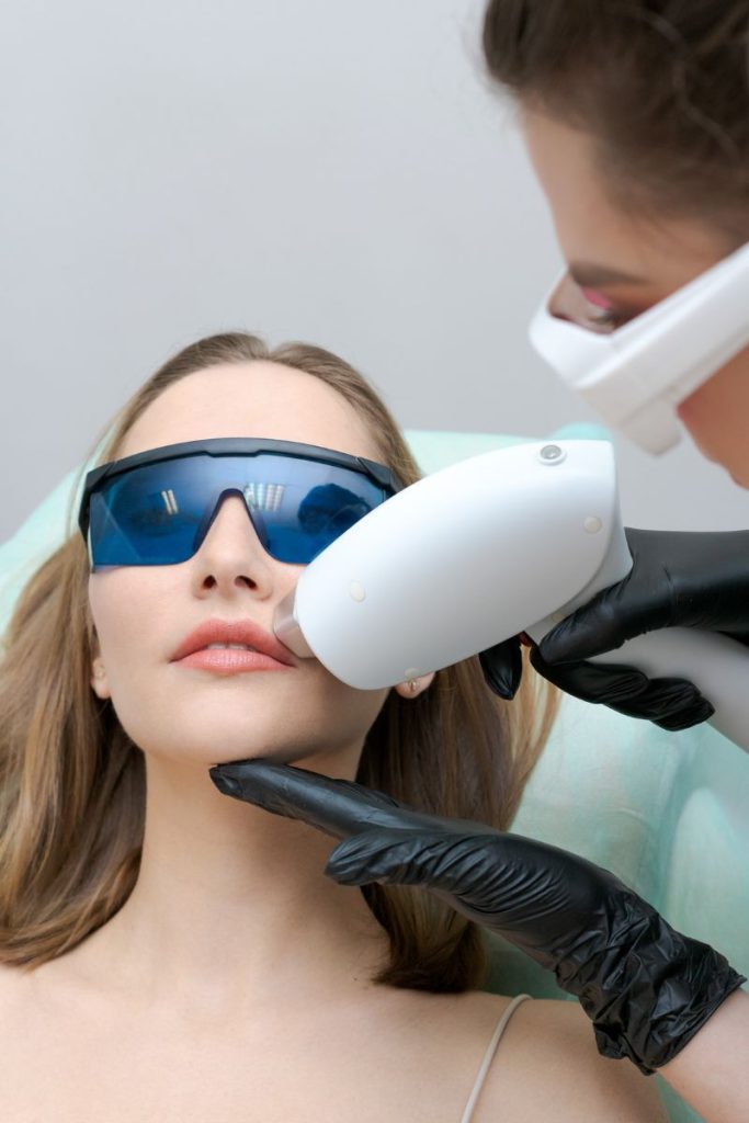 laser hair removal full face_