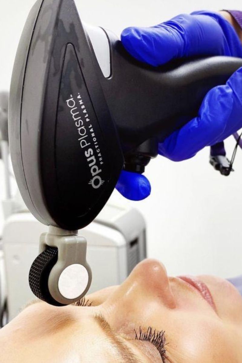 opus fractional RF skin tightening in leesburg va
